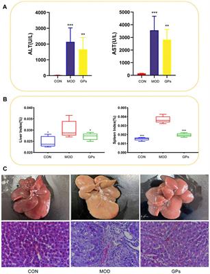 Label-free proteomic analysis reveals the hepatoprotective mechanism of gypenosides in liver injury rats